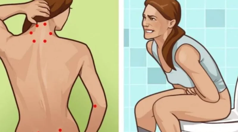 Les symptômes de la fibromylagie