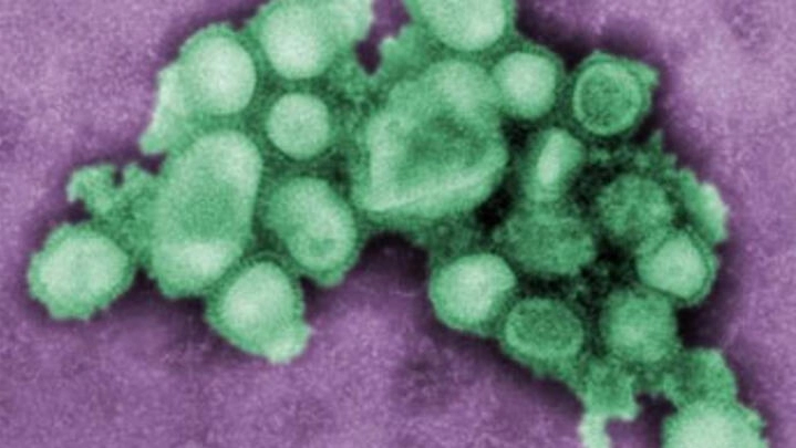 La grippe A (H1N1)