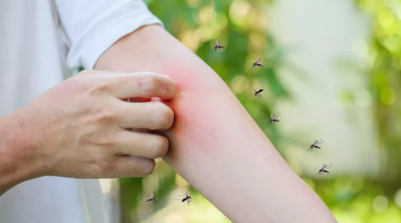 traitements naturels piqures d'insectes