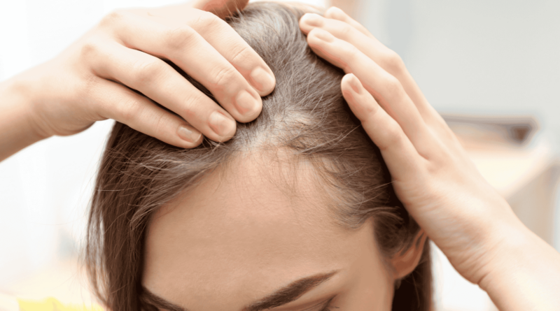 chute-de-cheveux-remede-naturel