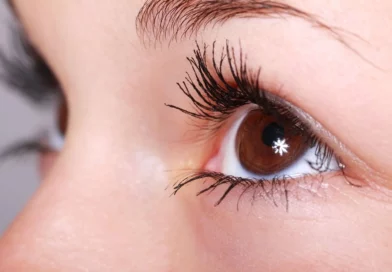 coup de soleil yeux
