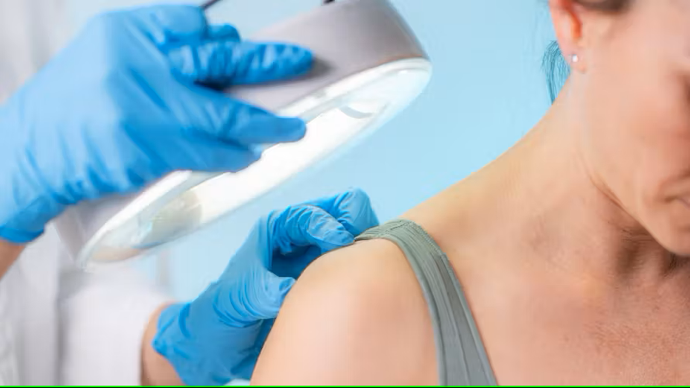 Acrochordons : c'est quoi ces excroissances sur la peau ?