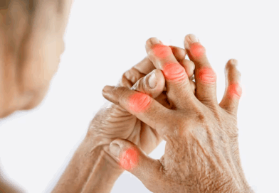 Remèdes naturels pour l'arthrite