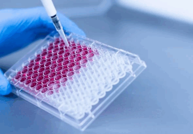 Cancer du côlon : une bactérie alimentaire pourrait en être la cause cachée – les experts s’inquiètent