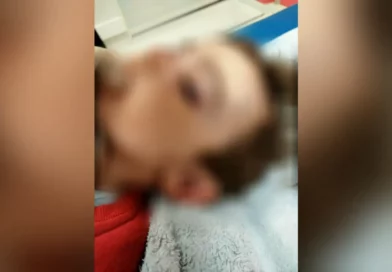 deux ans a ete attaque par un rat dans un logement social du Havre 2143823